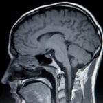 Smoking & Your Brain: Behavioral Effects